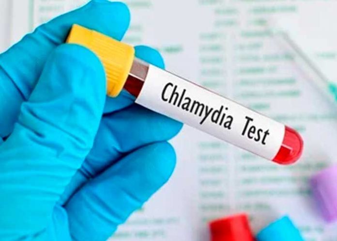 epidemias silenciosa