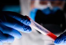 Conocé las peligrosas confusiones en el diagnóstico del coronavirus pandemia