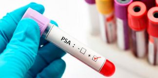biopsia