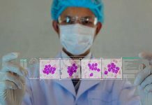 Nuevas terapias para leucemia linfocítica crónica se encaminan hacia la cura quimioterapia