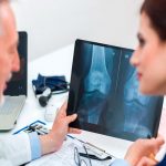 Osteoporosis: ¿Qué es, síntomas y tratamiento? calcio