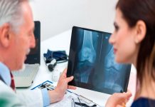 Osteoporosis: ¿Qué es, síntomas y tratamiento? calcio