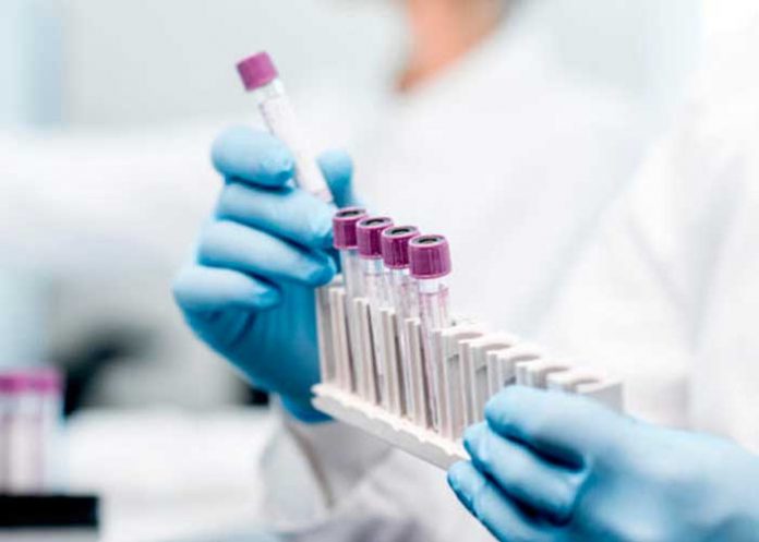 nota-9.1_AYspT39 antivirales