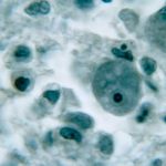 Florida confirma nuevo caso de la ameba «comecerebros» estados unidos