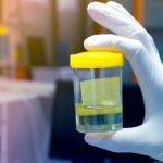 El curioso caso de una mujer que orina alcohol sin haberlo bebido patologia