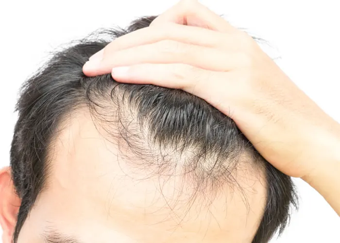 Ensayo muestra la capacidad de células madre para hacer crecer el cabello celulas madres