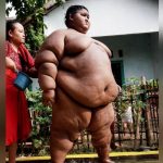 La transformacion del niño mas obeso del mundo obesidad