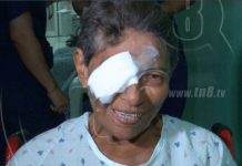 Centro Nacional de Oftalmología opera a pacientes con diversos problemas oculares nicaragua