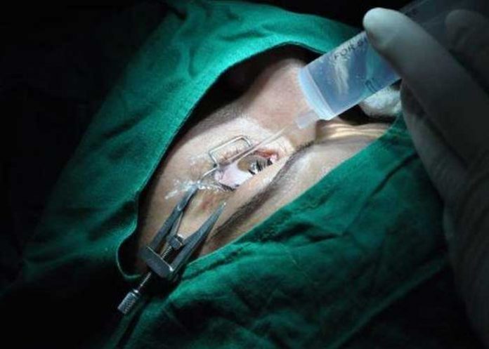 hombre pierde el ojo