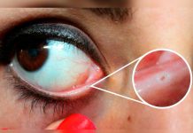 ¿Para qué sirven los pequeños orificios que tenemos en los ojos? ojo