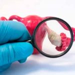 Identifican el origen genético de la insuficiencia ovárica primaria investigadores