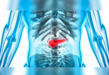 Conocé los síntomas de la pancreatitis y como prevenirla pancreatitis
