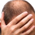 La calvicie y las canas podrán desaparecer por una nueva droga según científicos Estados unidos