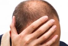 La calvicie y las canas podrán desaparecer por una nueva droga según científicos Estados unidos