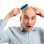 Verdades y mentiras sobre la calvicie verdades