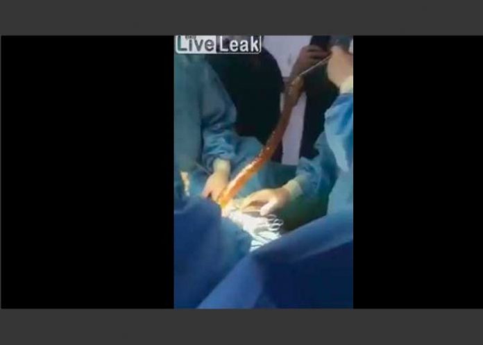 pene_PnYUTUG de muerte