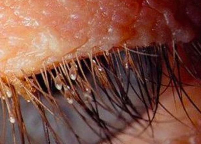 pestanas-postizas salud