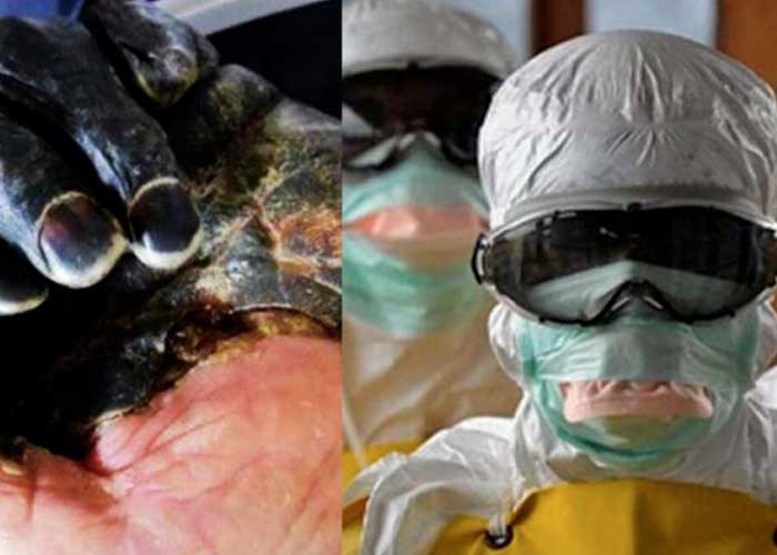 peste-bubonica zavkhan