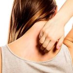 Esto quiere decir tu cuerpo cuando tienes picazón intensa picazon en la piel