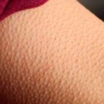 Descubre¿Para qué se nos pone la piel de gallina? salud