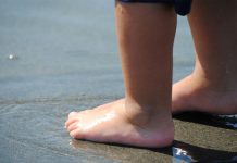 Decenas de huevos de pulgas carcomen los pies de una menor brasil