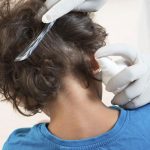 Los piojos, eternos enemigos de los chavalos