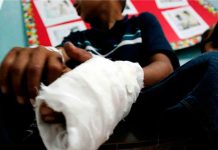 Seis quemados por pólvora en Nochebuena y Navidad en Honduras honduras
