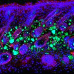 ¿Cómo envejece nuestra piel? envejecimiento