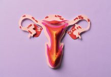 Todo lo que tienes que saber sobre la menstruación retrograda endometriosis
