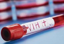 Más de 50 mil personas son portadoras de VIH en Guatemala vih