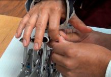 Existe un dispositivo para rehabilitar dedos de la mano y es de bajo costo