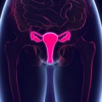 Esta es la enfermedad silenciosa que podría destruir tu útero adenomiosis