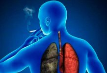 cancer de pulmon