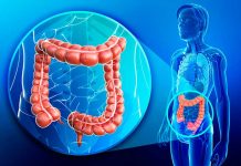 Encuentran 40 variantes genéticas que predisponen al cáncer colorrectal cancer colorrectal
