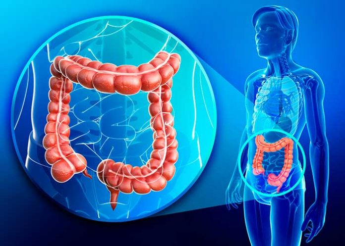 portada_F7uzcga cancer colorrectal