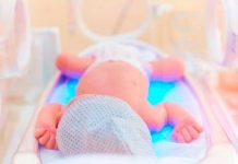 30 millones de bebés necesitan cuidado especial para sobrevivir recien nacidos