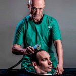 trasplante de cabeza