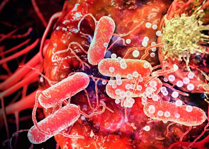 portada_KwqJFCg cancer