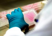 Migración podría elevar contagios por hepatitis C hepatitis c