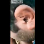 Mira el asqueroso insecto que le extrajeron del oído a un hombre en la India video