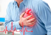 infarto