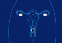 Anillo vaginal anticonceptivo reutilizable. Te lo quitas y pones anillo