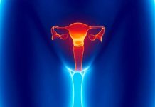 Fibrosis Uterina, todo lo que debes saber de esta enfermedad fibrosis uterina