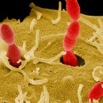 Esta bacteria se aloja en tu boca y luego ataca tu corazón bacteria