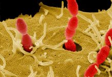 Esta bacteria se aloja en tu boca y luego ataca tu corazón bacteria