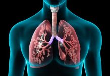 Preparan un tratamiento más corto y eficaz para la tuberculosis tuberculosis activa