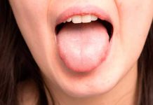 Infecciones bucales pueden causar desde amigdalitis a cardiopatías salud