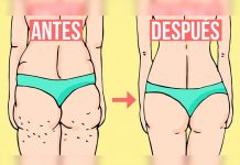 El mejor truco para eliminar las celulitis, según dermatólogos