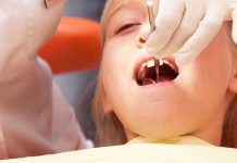 Cambios en alimentación de niños influye en incremento de caries nina en el dentista