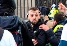 Enfrentamiento entre «chalecos amarillos» y policía francesa deja a un manifestante sin mano francia